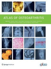 Atlas of Osteoarthritis