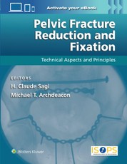 Pelvic Fracture Reduction and Fixation