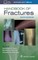 Handbook of Fractures