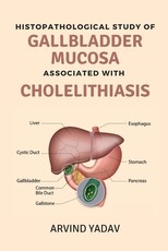 Histopathological Study of Gallbladder Mucosa Associated With Cholelithiasis