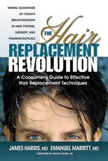 The Hair Replacement Revolution