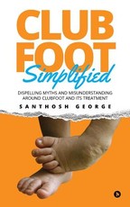 Clubfoot Simplified