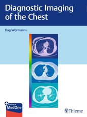 Diagnostic Imaging of the Chest
