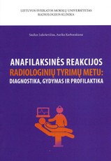 Anafilaksinės reakcijos radiologinių tyrimų metu: diagnostika, gydymas ir profilaktika