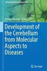 Development of the Cerebellum from Molecular Aspects to Diseases