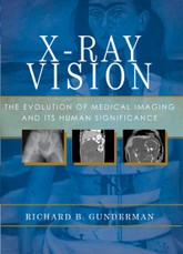 X-Ray Vision
