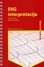 EKG interpretacija. Kišeninis vadovas