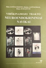 Virškinamojo trakto neuroendokrininiai navikai