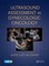 Ultrasound Assessment in Gynecologic Oncology