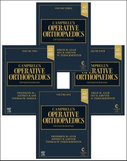 Campbell's Operative Orthopaedics, 4-Volume Set