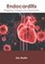 Endocarditis: Diagnosis, Therapy and Prevention