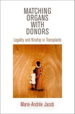 Matching Organs with Donors