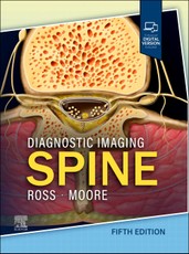 Diagnostic Imaging: Spine