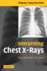 Interpreting Chest X-Rays