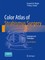 Color Atlas Of Strabismus Surgery