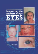 Inspecting the Newborn Baby's Eyes