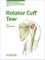 Rotator Cuff Tear