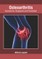Osteoarthritis: Symptoms, Diagnosis and Treatment