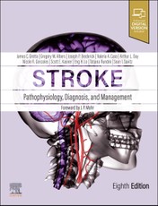 Stroke: Pathophysiology, Diagnosis, and Management