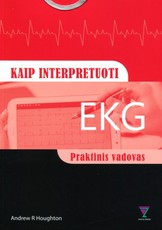 Kaip interpretuoti EKG. Praktinis vadovas