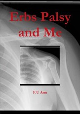 Erbs Palsy and Me