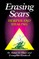 Erasing Scars