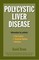Polycystic Liver Disease: Information for Patients