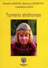Turnerio sindromas
