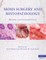 Mohs Surgery and Histopathology