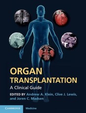Organ Transplantation