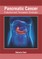 Pancreatic Cancer: Evaluation and Therapeutic Strategies