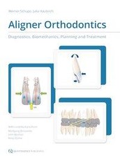 Aligner Orthodontics