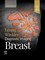Diagnostic Imaging: Breast