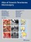 Atlas of Acoustic Neurinoma Microsurgery