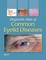 Diagnostic Atlas of Common Eyelid Diseases