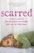 Scarred