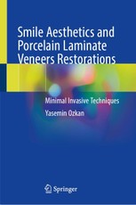 Smile Aesthetics and Porcelain Laminate Veneers Restorations