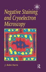 Negative Staining and Cryoelectron Microscopy