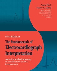The Fundamentals of Electrocardiograph Interpretation