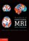 Handbook of Functional MRI Data Analysis