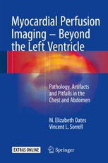 Myocardial Perfusion Imaging - Beyond the Left Ventricle