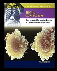Skin Cancer