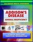 21st Century Addison's Disease Sourcebook: Clinical Data for Patients, Families, and Physicians, including Adrenal Insufficiency, Adrenocortical Hypofunction, Hypocortisolism, and Related Conditions