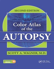 Color Atlas of the Autopsy