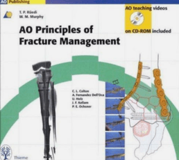 AO Principles of Fracture Management