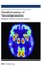 Metallochemistry of Neurodegeneration