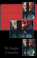 Head Transplantation