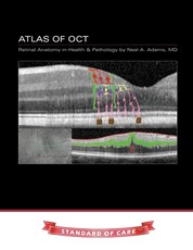 Atlas of OCT
