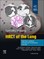 Martínez-Jiménez, S: Specialty Imaging: HRCT of the Lung