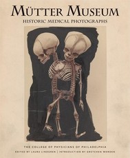 MÃ¼tter Museum Historic Medical Photographs